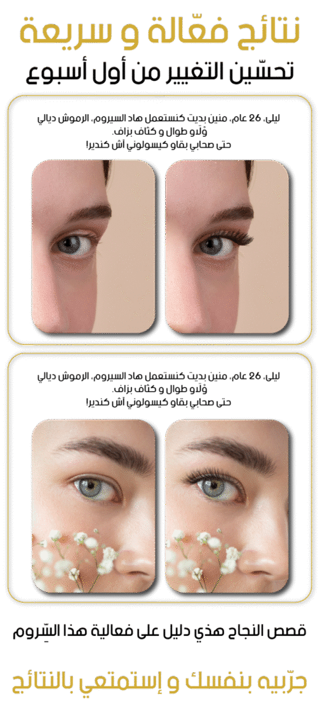 eyelash landing 01